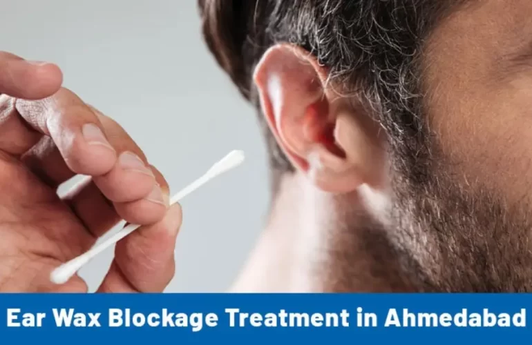 Ear Wax Blockage Treatment in Ahmedabad