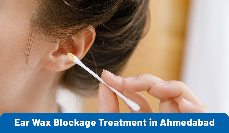 Ear Wax Blockage Treatment in Ahmedabad