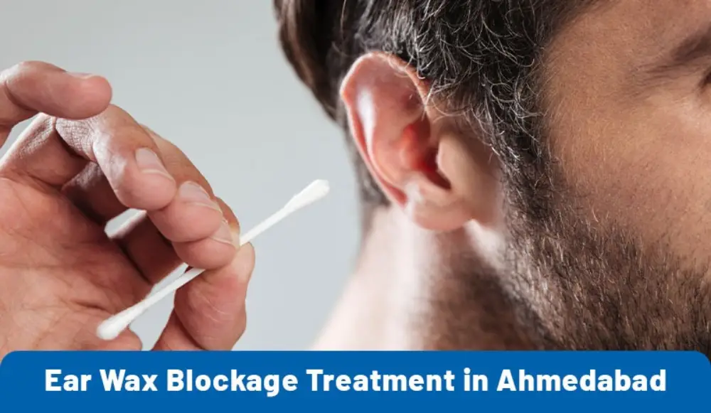 Ear Wax Blockage Treatment in Ahmedabad