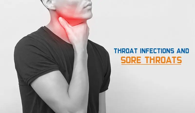 Throat Infections and Sore Throats