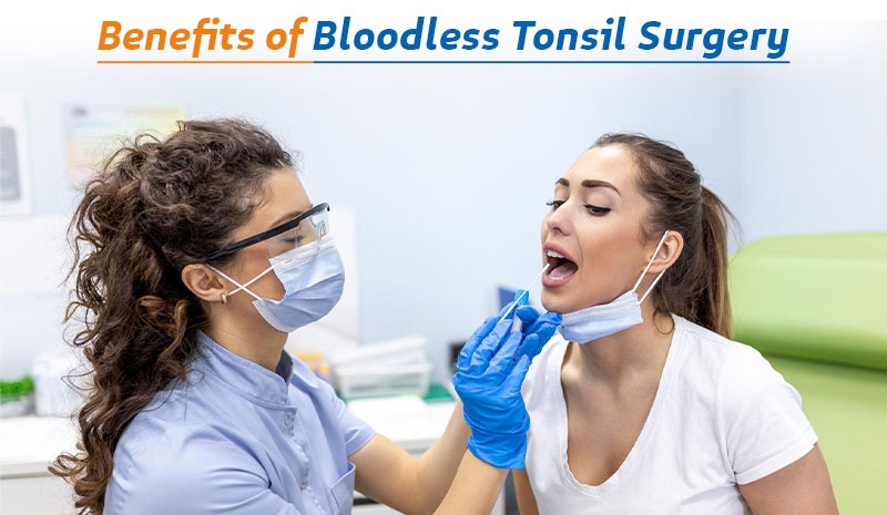 Benefits of Bloodless Tonsil Surgery