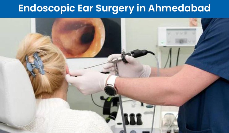 Endoscopic Ear Surgery in Ahmedabad