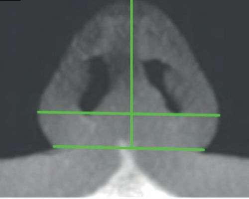 CBCT Nose Scan in Ahmedabad