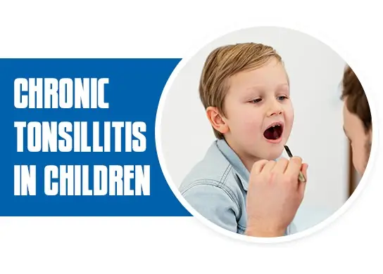 Chronic Tonsillitis in Children