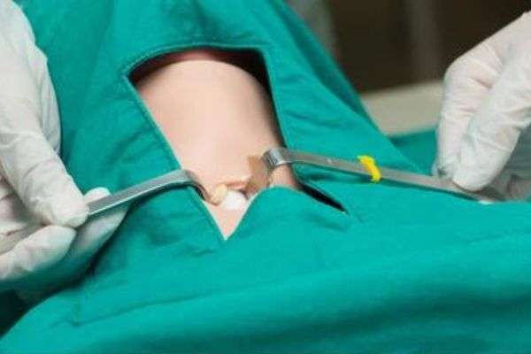 Throat Surgery in Ahmedabad