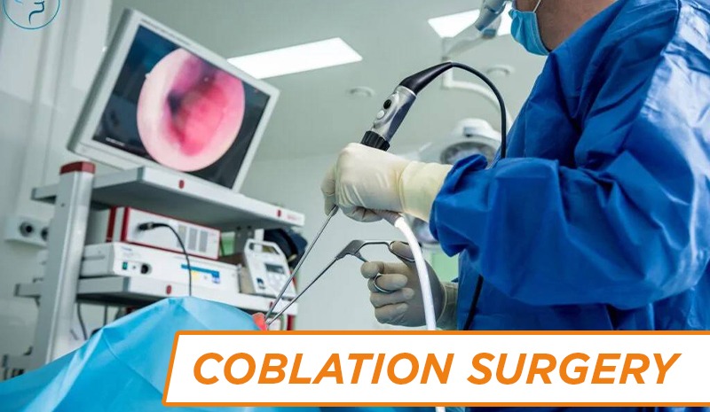 Coblation Surgery