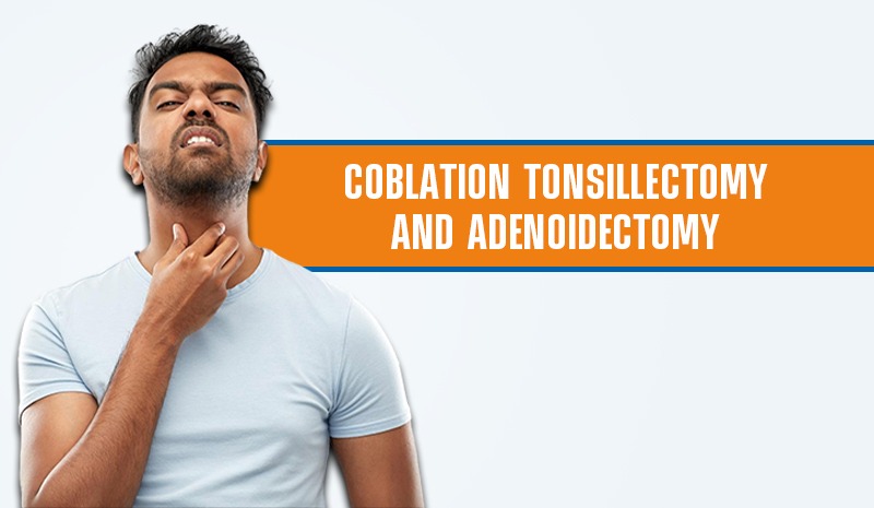 Coblation Tonsillectomy and Adenoidectomy
