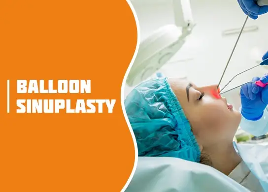 Balloon Sinuplasty