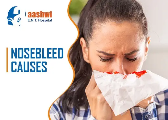 Nosebleed Causes