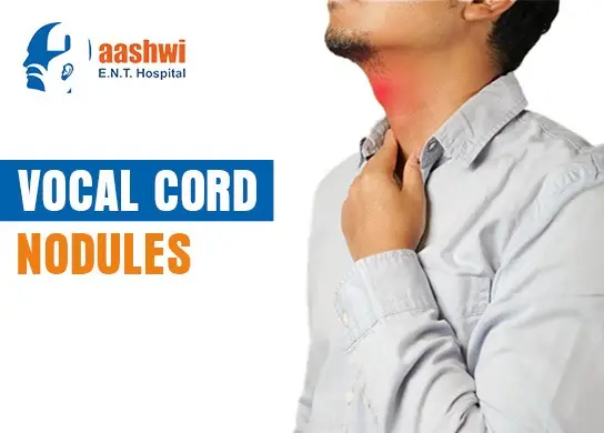 Vocal Cord Nodules