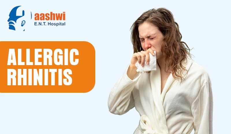 Allergic Rhinitis