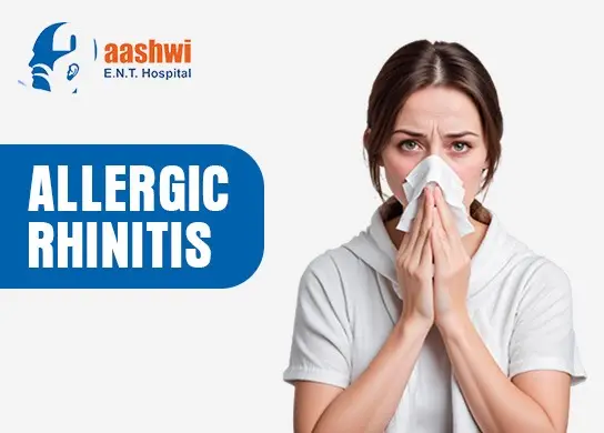 Allergic Rhinitis