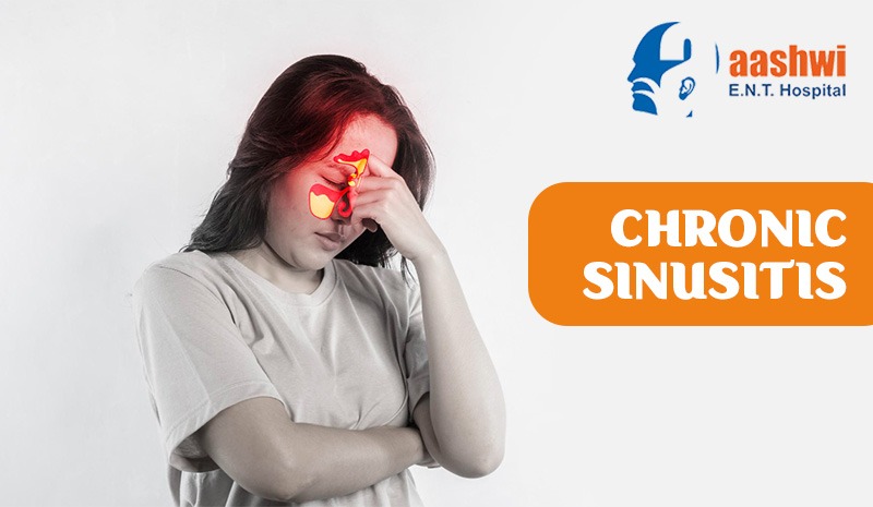 Chronic Sinusitis