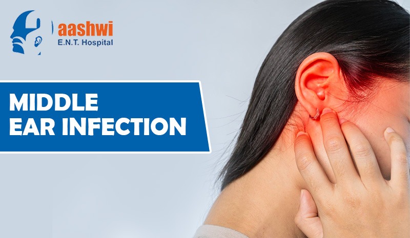 Middle Ear Infection