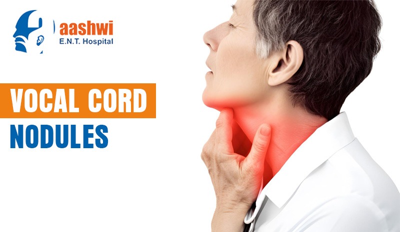 Vocal Cord Nodules