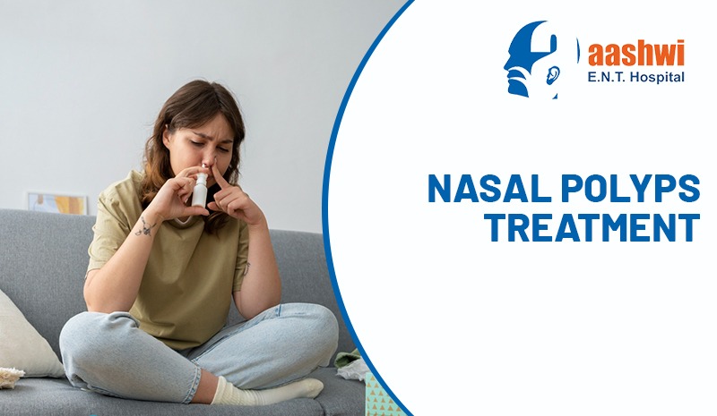 Nasal Polyps Treatment