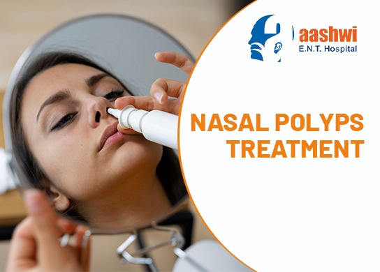 Nasal Polyps Treatment